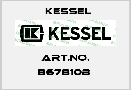 Art.No. 867810B  Kessel